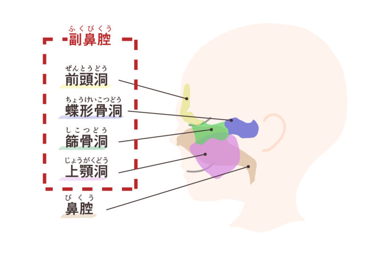 副鼻腔炎の種類・原因